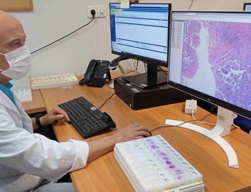 El Hospital de Alzira digitalizará las más de 23.000 biopsias y muestras de tejido que realiza cada año